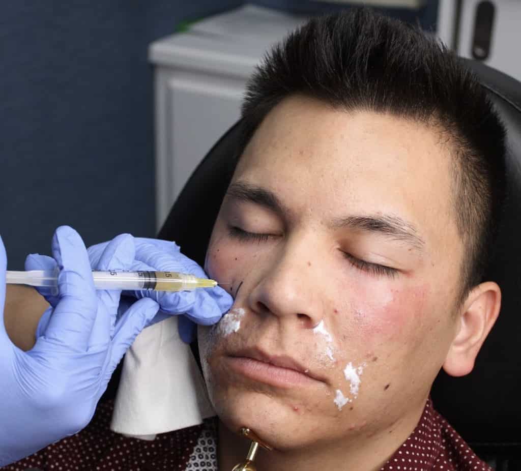 Portfolio 36 VAMPIRE TREATMENTS | Cloud 9 MedSpa | Casa Grande, AZ