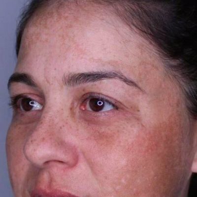 Gallery | Cloud 9 MedSpa | Casa Grande, AZ