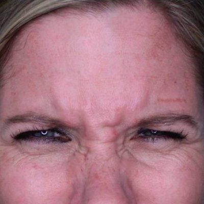 Gallery | Cloud 9 MedSpa | Casa Grande, AZ